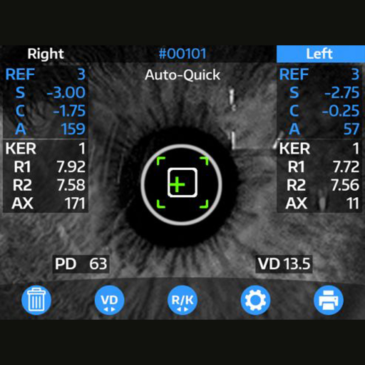 Reichert OptoChek Plus Autorefractor/Keratometer (Pre-Owned) UI screen