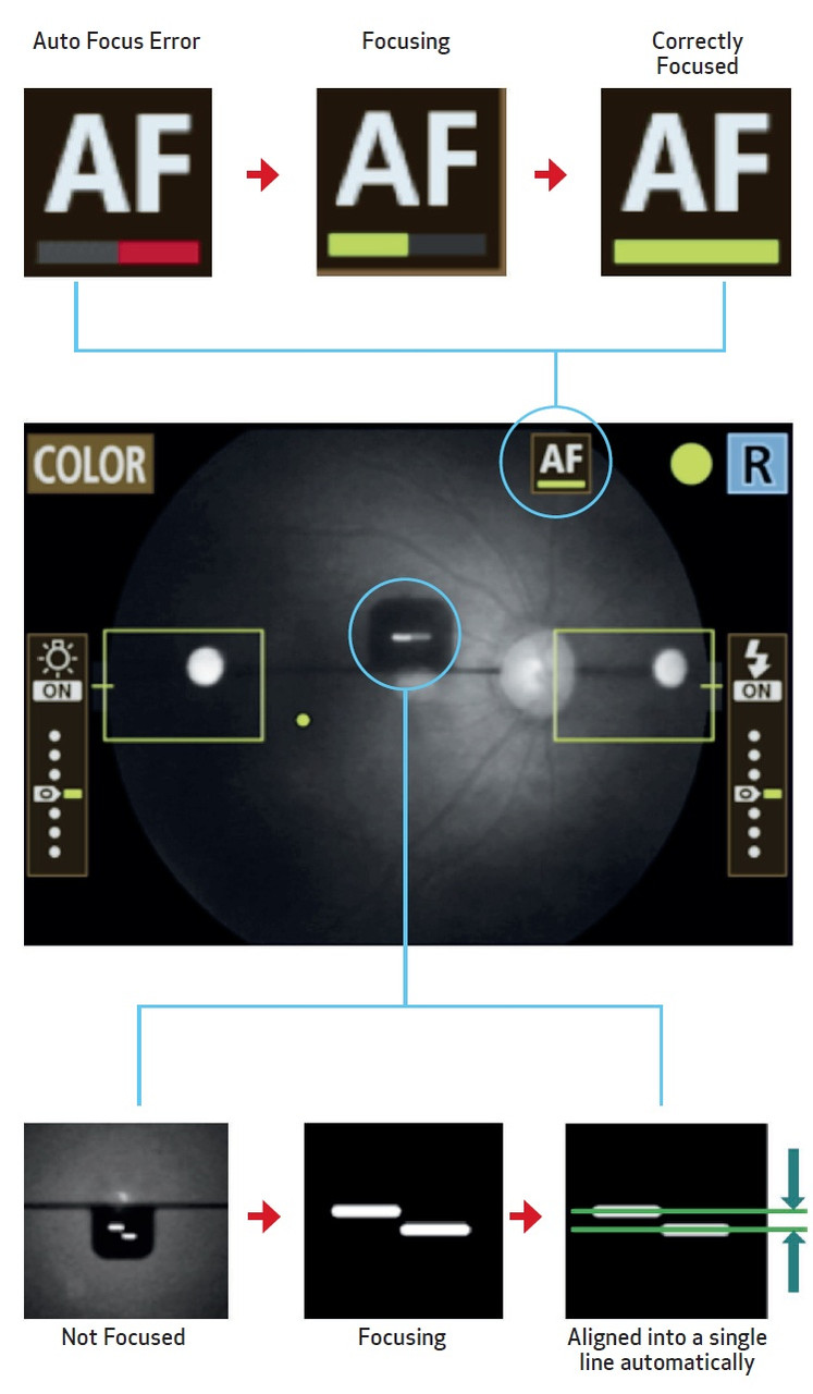 Canon CR-2 PLUS AF Digital Non-Mydriatic Retinal Camera Screenshots