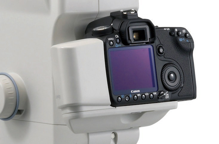 Canon CX-1 Hybrid Digital Mydriatic/Non-Mydriatic Retinal Camera